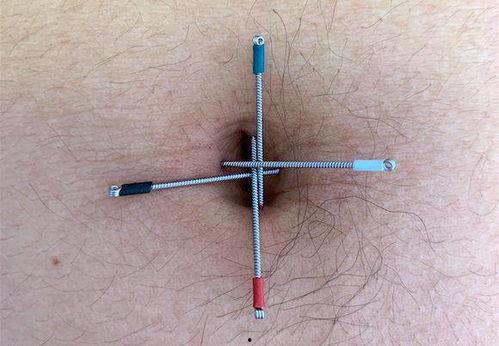 肚脐针视频,视频带你领略中医养生新境界