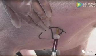 采血视频,视频带你直观了解血液采集全流程